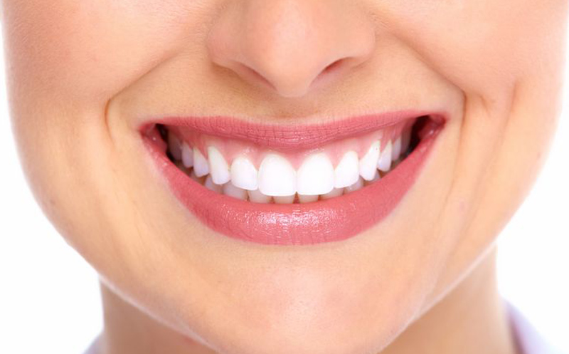 Bild Veneers - Veneers sind eine schonende und zugleich hoch ästhetische Möglichkeit, ein schönes Gebiss mit strahlend weißen Zähnen zu bekommen.